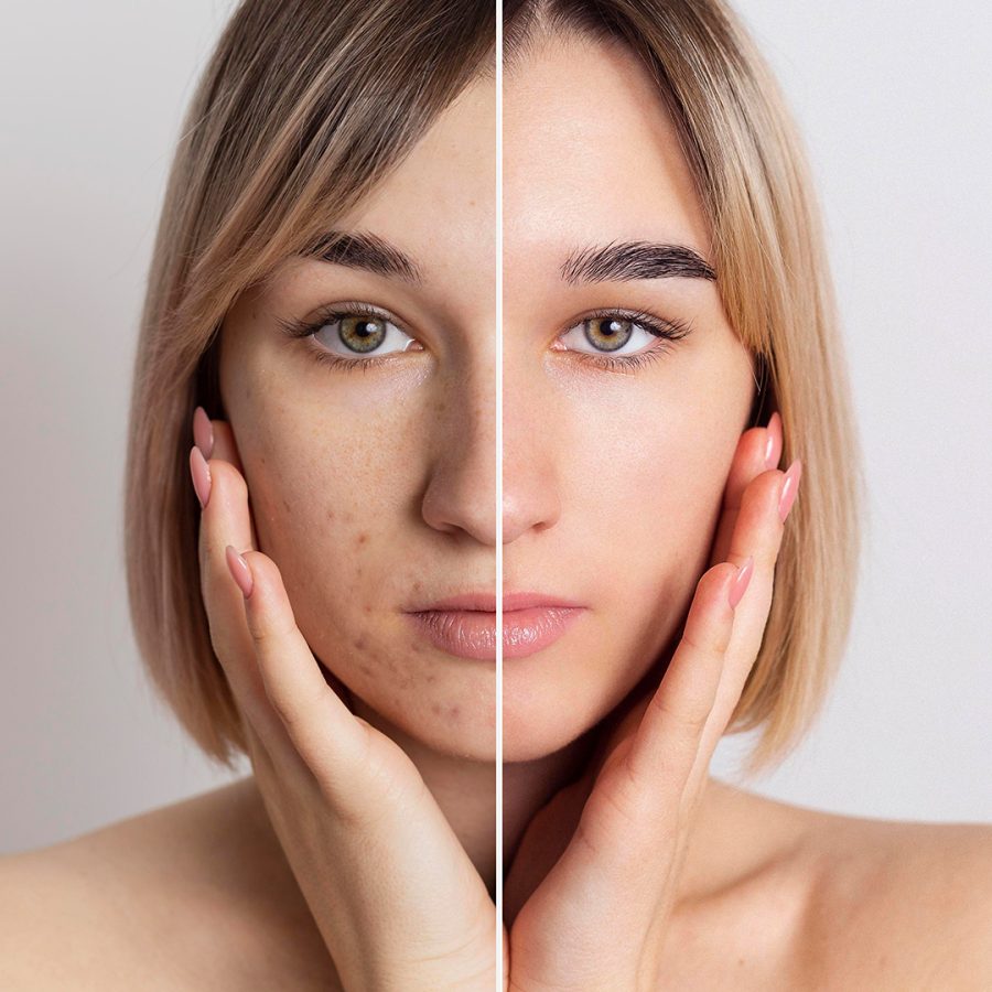 Products-EyeLift-Prestige-Serum-08